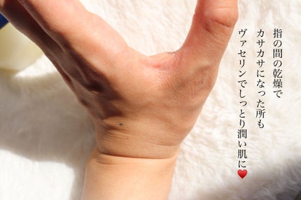 オリジナル ピュアスキンジェリー/ヴァセリン/ボディクリームを使ったクチコミ(3枚目)