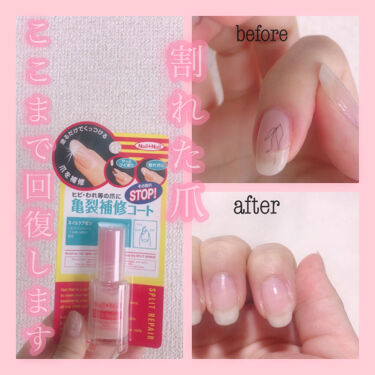 カラフルネイルズ キャンメイクを使った口コミ 割れ爪一瞬で治った話聞いて下さい こ By ねころびちゃん 普通肌 代前半 Lips