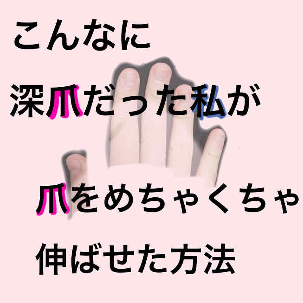 ネイルサポート Na/ネイルネイル/ネイルトップコートを使ったクチコミ(1枚目)