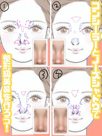 ディオールスキン フォーエヴァー スキン コレクト コンシーラー/Dior/リキッドコンシーラーを使ったクチコミ(1枚目)