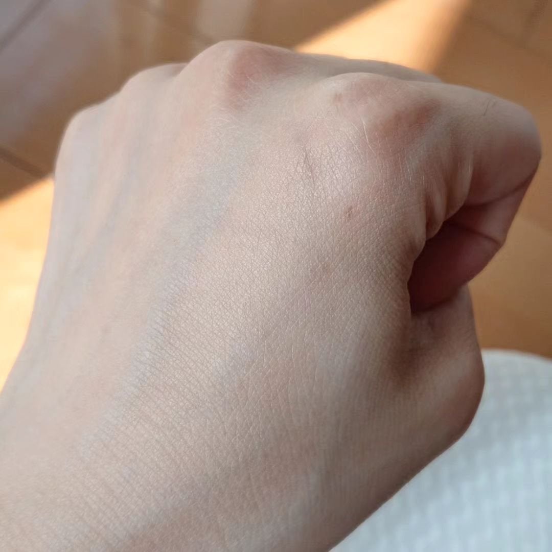 ããã³ ã¢ããã¢ã€ã¹ã ãšã€ãžã³ã°ã±ã¢ ãã€ã¯ãªãŒã UV/ããã³/æ¥çŒãæ¢ãã¯ãªãŒã ã䜿ã£ãã¯ãã³ãïŒ3æç®ïŒ