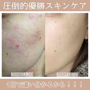 キールズ ハーバル トナー CL アルコールフリー/Kiehl's/化粧水を使ったクチコミ（1枚目）