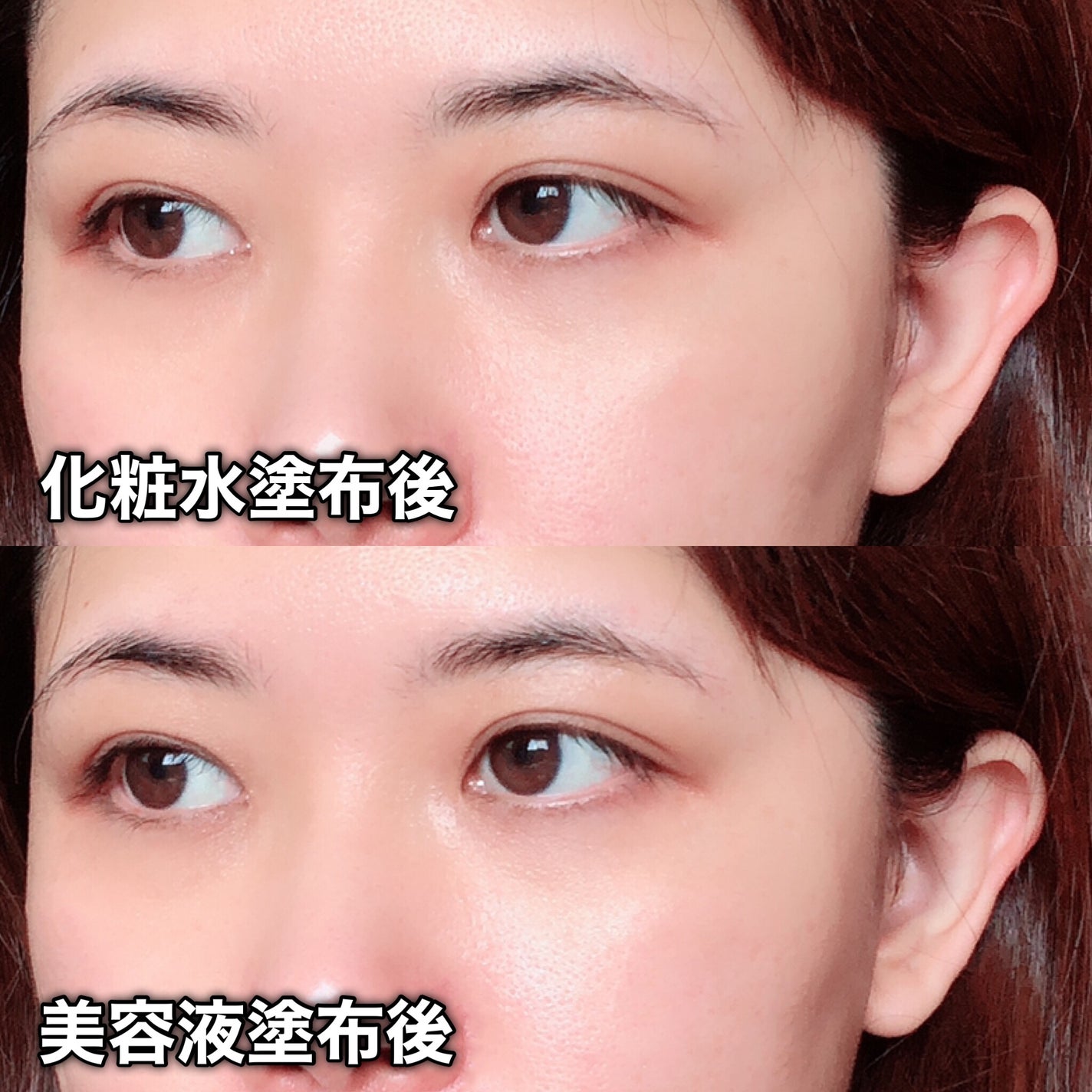 yuki/フォロバします❤️ on LIPS 「AnuaAZELAICACID15INTENSECALMING..」(7枚目)