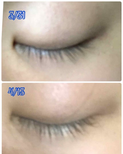 THE まつ毛美容液/UZU BY FLOWFUSHI/まつげ美容液を使ったクチコミ(2枚目)