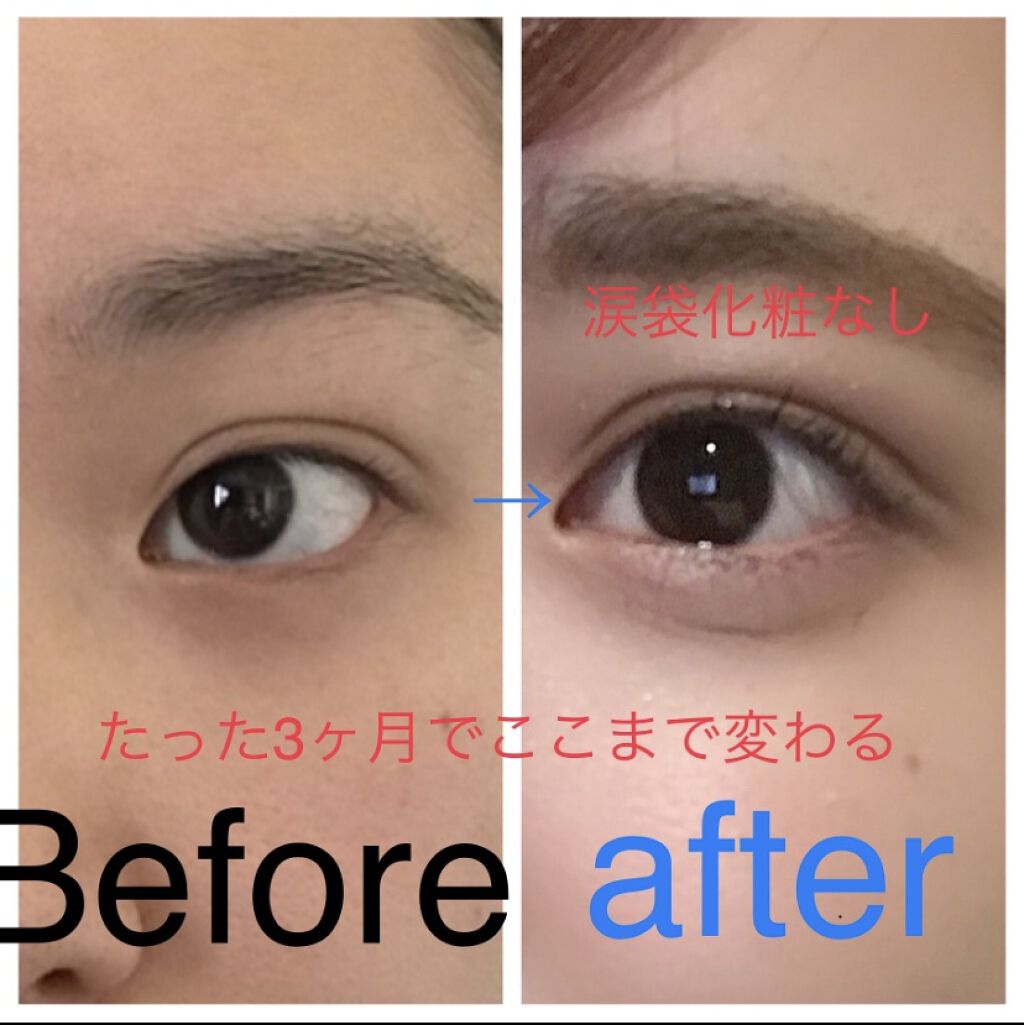 アイラッシュフィクサーEX 552/D-UP/つけまつげを使ったクチコミ（1枚目）