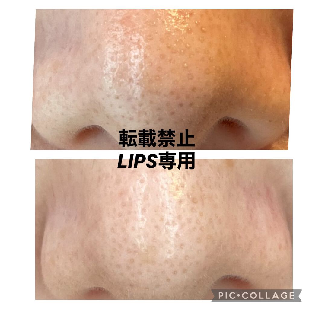 ノーモアブラックヘッド(ノーズピーリング)/One-day's you/スクラブ・ゴマージュを使ったクチコミ（2枚目）