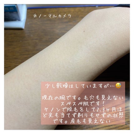 光美容器KE-NON(ケノン)/エムテック/家庭用脱毛器を使ったクチコミ(3枚目)