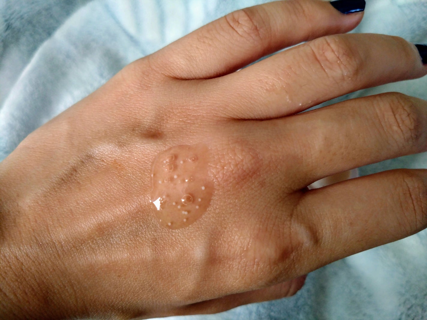 トーンブライトニング カプセルアンプル/SKIN1004/美容液を使ったクチコミ(2枚目)