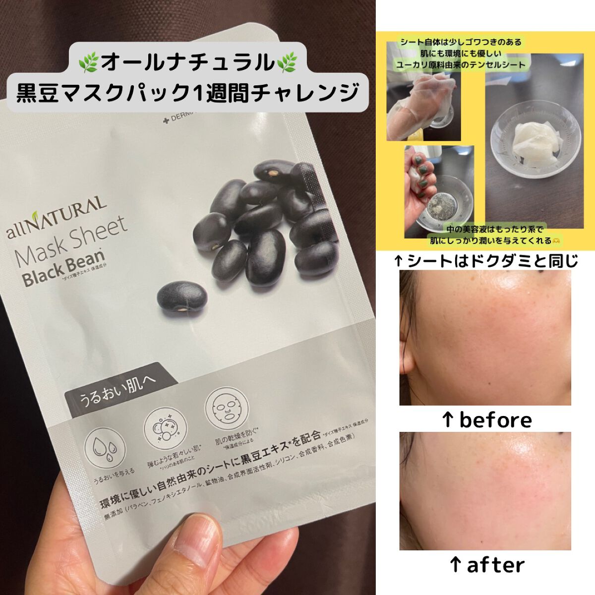 オールナチュラル マスクパックKM/allNATURAL/シートマスク・パックを使ったクチコミ(1枚目)