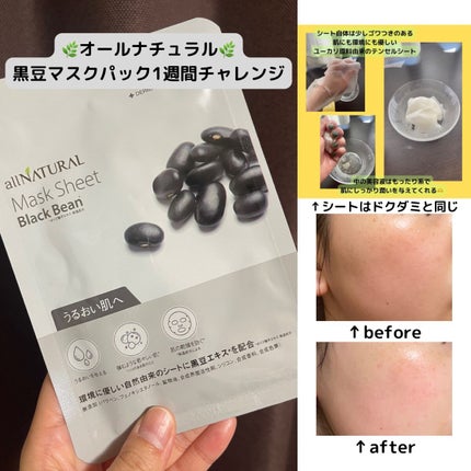 オールナチュラル マスクパックKM/allNATURAL/シートマスク・パックを使ったクチコミ(1枚目)