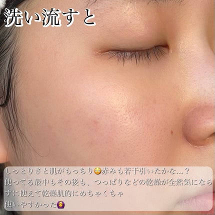 フェイシャル エッセンス クリームマスク/COCOCHI/フェイスクリームを使ったクチコミ(8枚目)