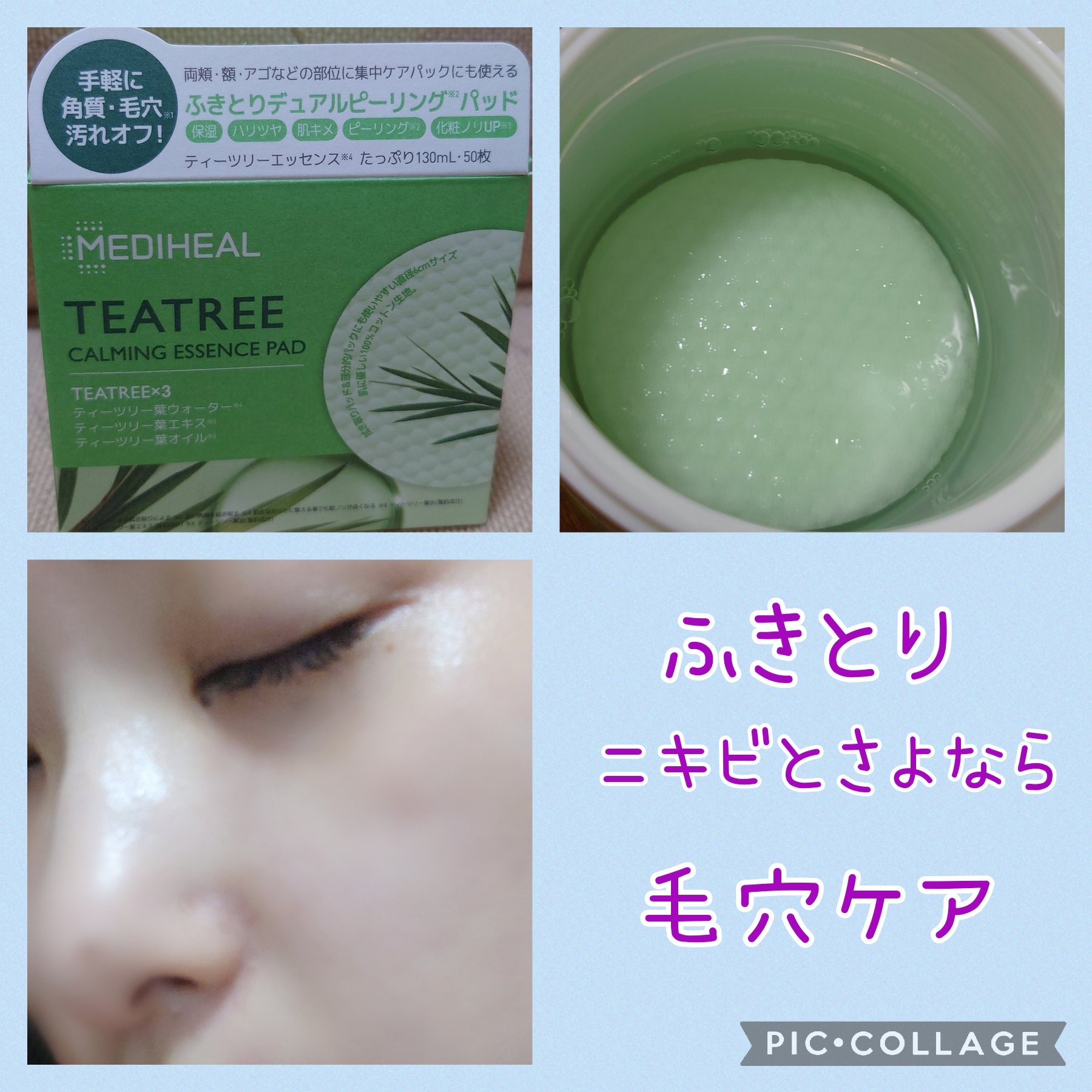 MEDIHEALティーツリーカーミングエッセンスパッド
愛用して長くお世話になってる

ふきとり化粧水

クレンジングした後でもこのふきとりで

ツルツルになります✨

ニキビ予防として毛穴につまった汚れをキレイに✨

液がひたひたたっぷり