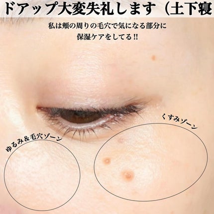 N organic Basic コンディショニング VCエッセンス/N organic/美容液を使ったクチコミ(4枚目)