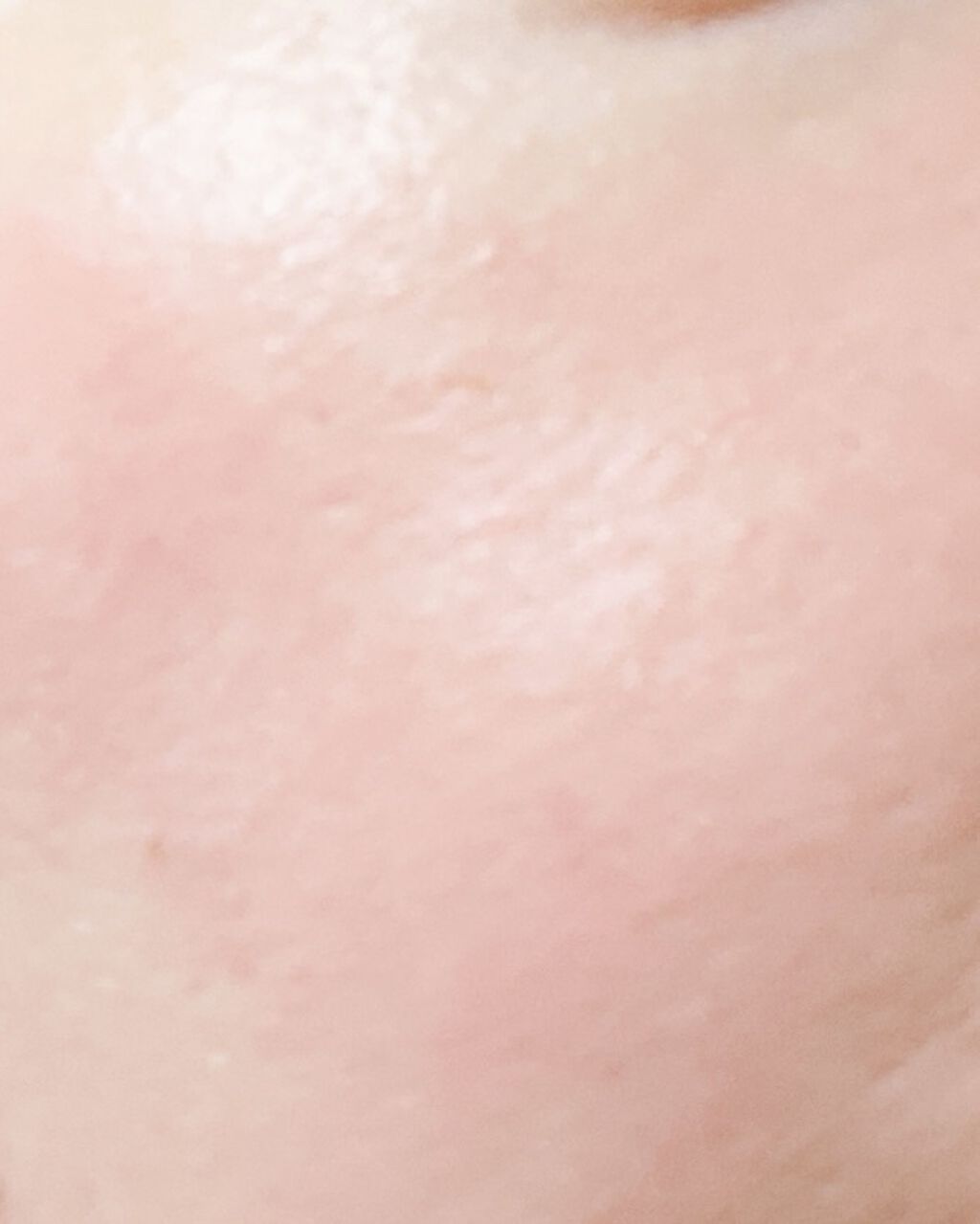 スキンケアプログラム AD/ACSEINE/トライアルキットを使ったクチコミ（3枚目）