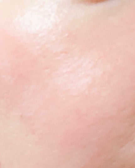 スキンケアプログラム AD/ACSEINE/トライアルキットを使ったクチコミ(3枚目)