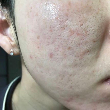 キャスターオイル/Now Foods/その他スキンケアを使ったクチコミ(1枚目)