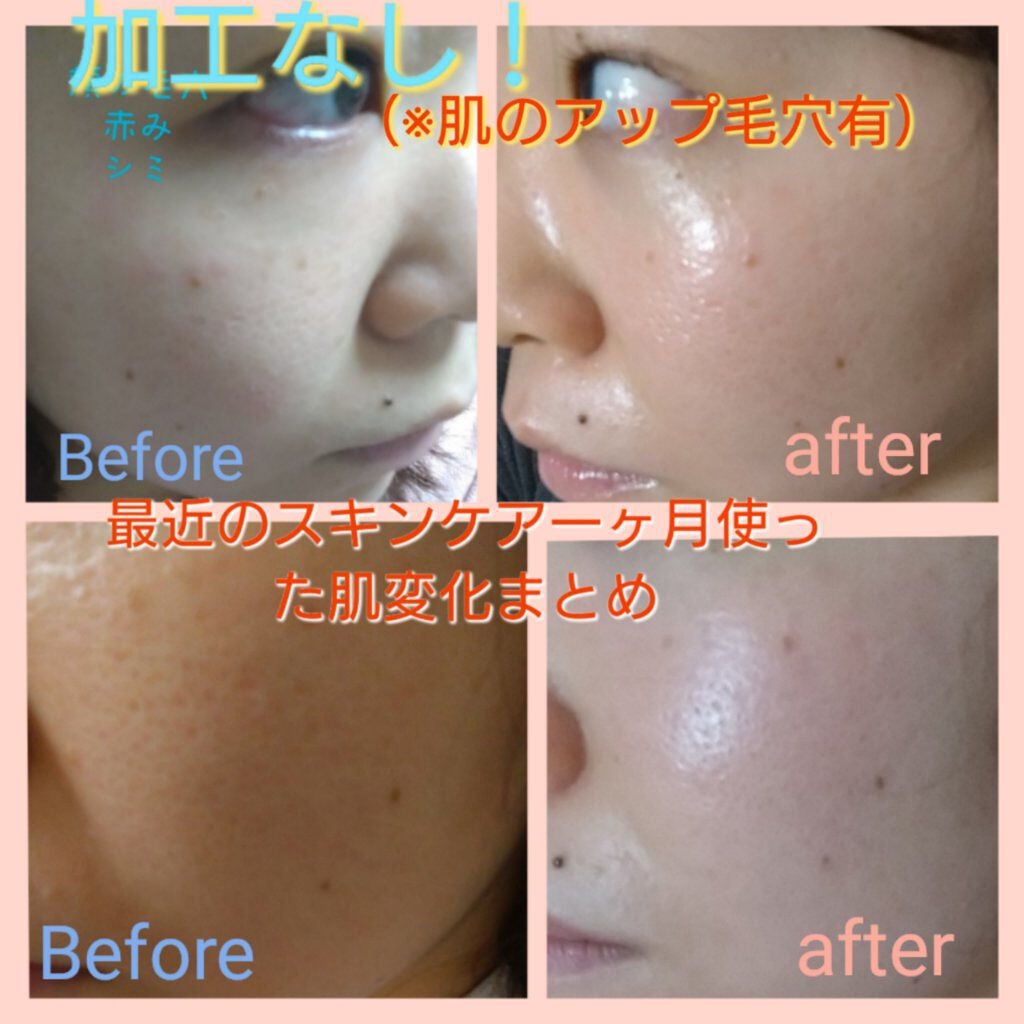 目ざまシート ひきしめタイプ/サボリーノ/シートマスク・パックを使ったクチコミ(1枚目)