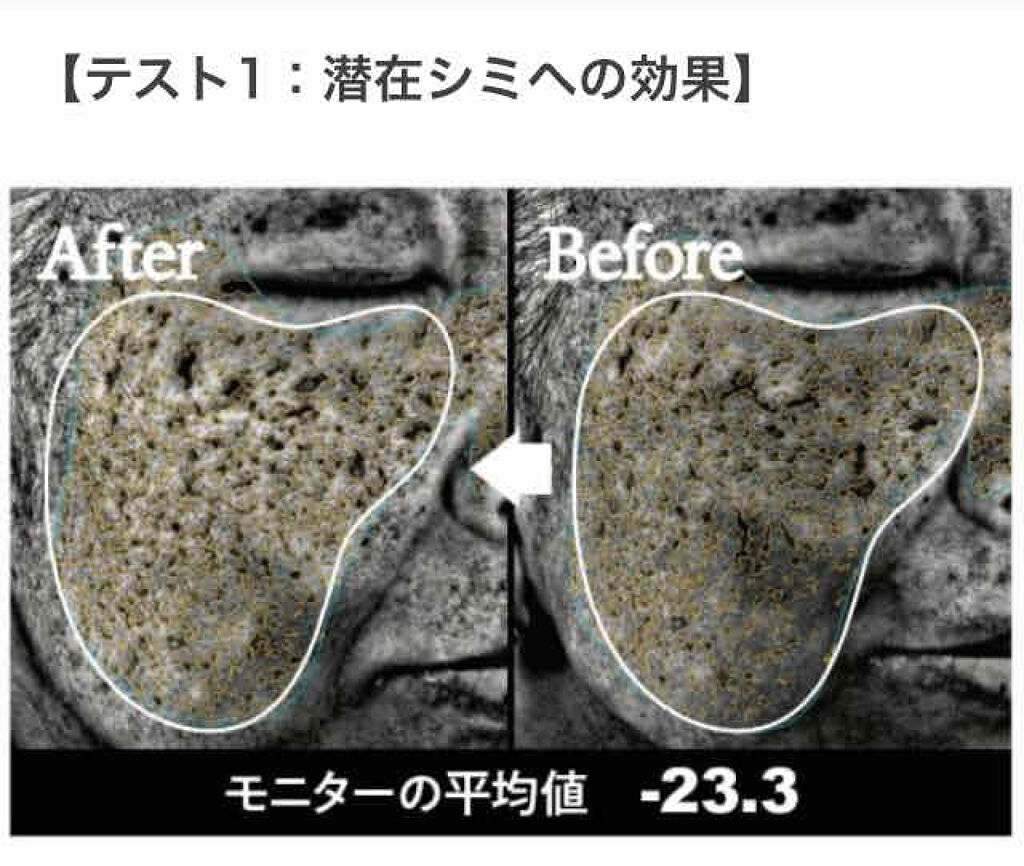 エストG.P. エンリッチドセラム リフトモイスト/est/美容液を使ったクチコミ（2枚目）