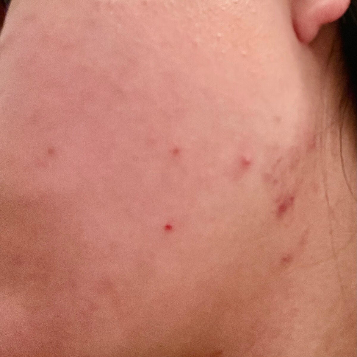 ハトムギ化粧水(ナチュリエ スキンコンディショナー R )/ナチュリエ/化粧水を使ったクチコミ(4枚目)