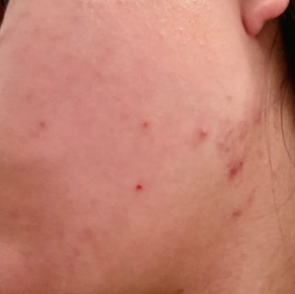 ハトムギ化粧水(ナチュリエ スキンコンディショナー R )/ナチュリエ/化粧水を使ったクチコミ(4枚目)