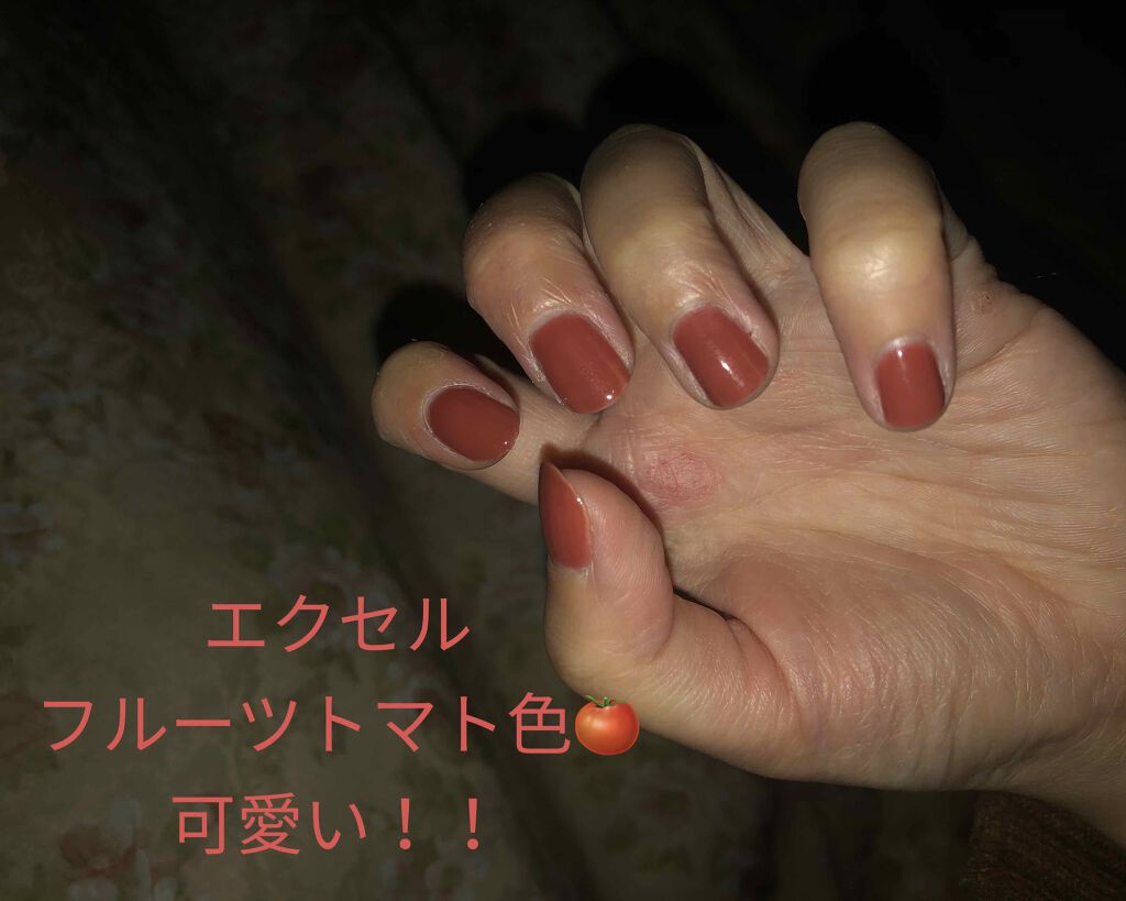 スピーディ トップコートR/シュガードール/ネイルトップコートを使ったクチコミ（1枚目）