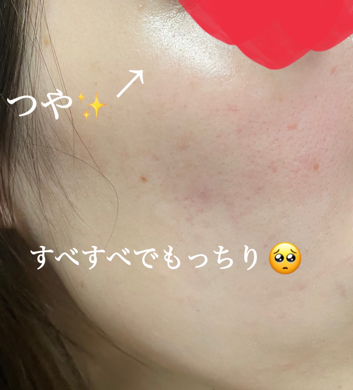 セラム シールド/ONE BY KOSE/フェイスバームを使ったクチコミ(4枚目)