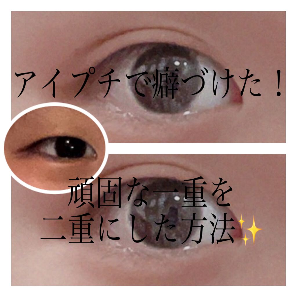 アイトーク クリアジェル/アイトーク/二重まぶた用アイテムを使ったクチコミ（1枚目）