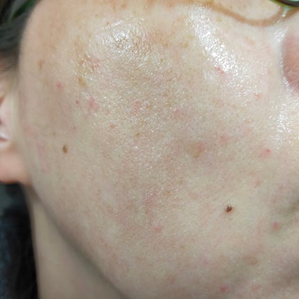 原液美容100マスク VC&レチノール/ONE STONE TWO BIRDS/シートマスク・パックを使ったクチコミ(6枚目)