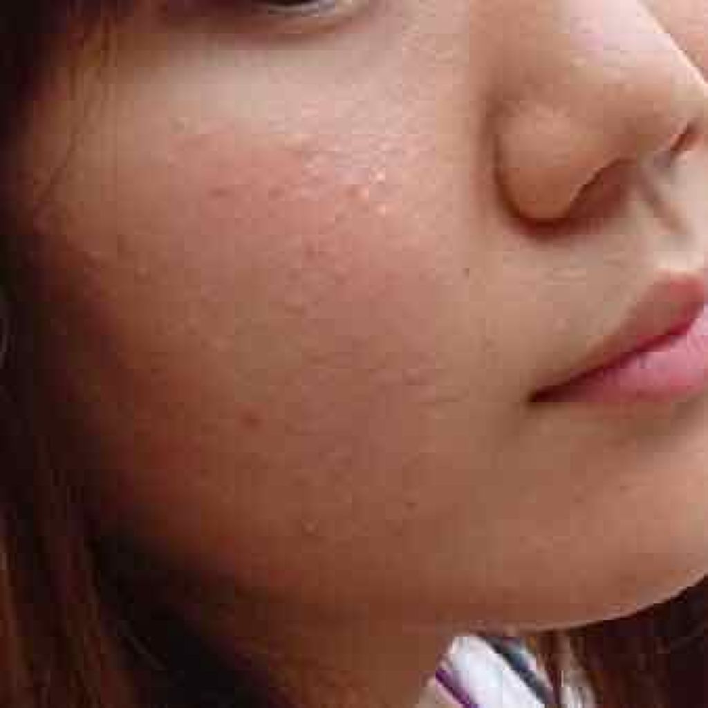 カンダンバリア エッセンス/d プログラム/美容液を使ったクチコミ（3枚目）