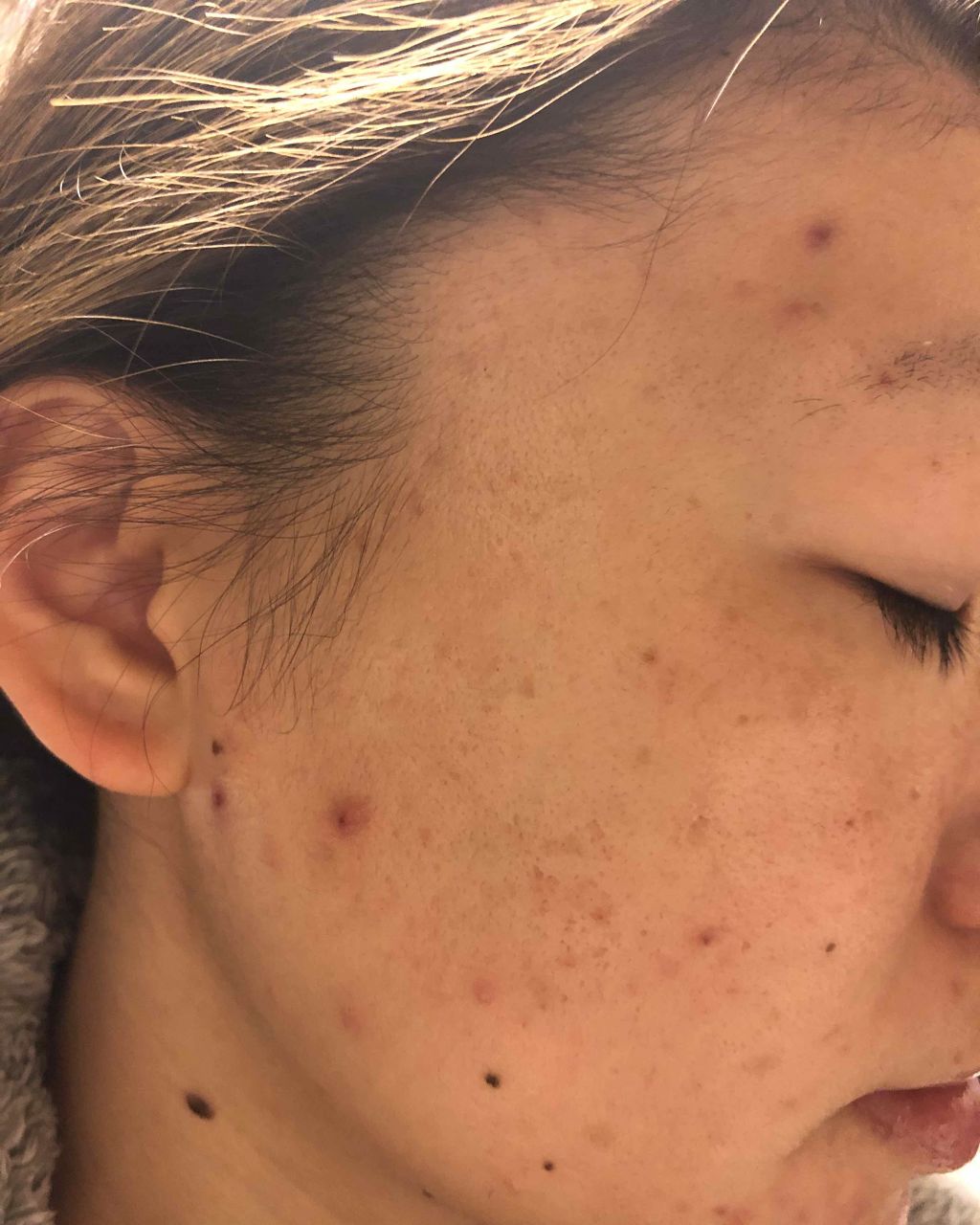 たま on LIPS 「夜のスキンケアです顔面テカテカヒルドイドのもちもち感すごい。も..」(2枚目)