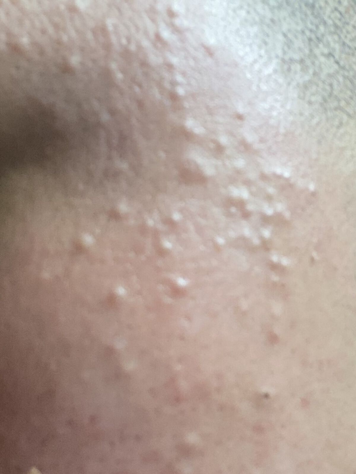 リペアソープ/コラージュリペア/洗顔石鹸を使ったクチコミ（1枚目）