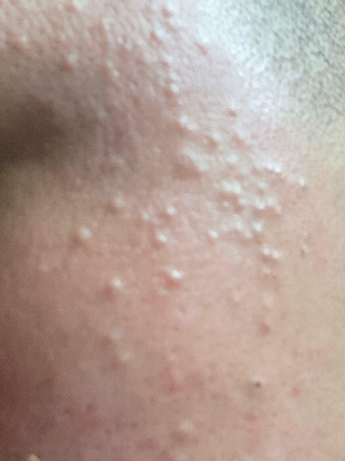 リペア薬用保湿化粧水 とてもしっとり/コラージュ/化粧水を使ったクチコミ(1枚目)