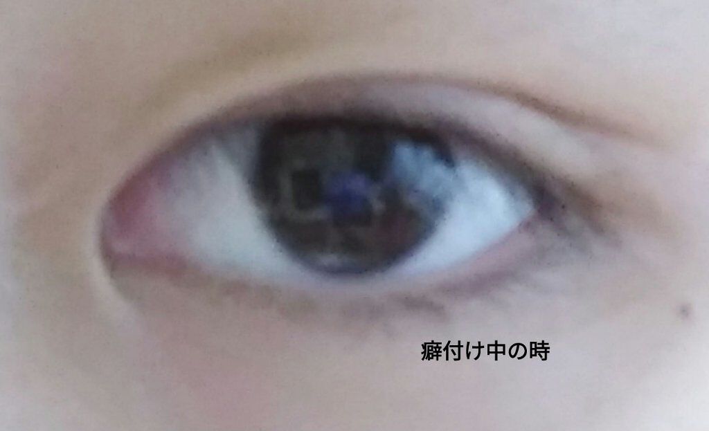 ふたえの衝撃 アイビューティーリキッド/ロージーローザ/二重まぶた用アイテムを使ったクチコミ（3枚目）