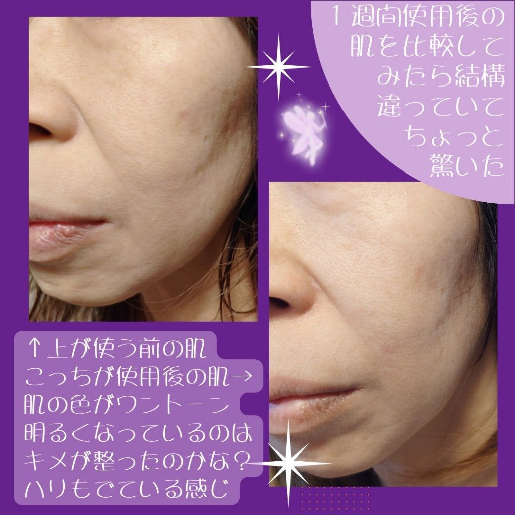 リードルショット100/VT/美容液を使ったクチコミ(4枚目)