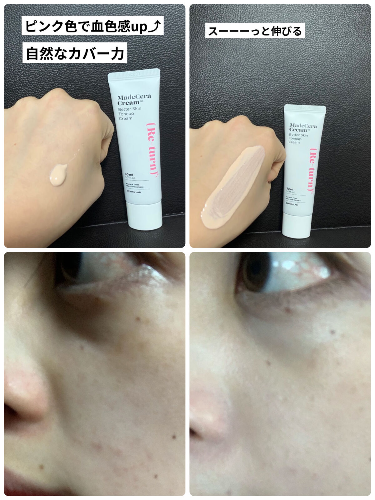 マデセラクリーム/SKINRx LAB/フェイスクリームを使ったクチコミ（2枚目）