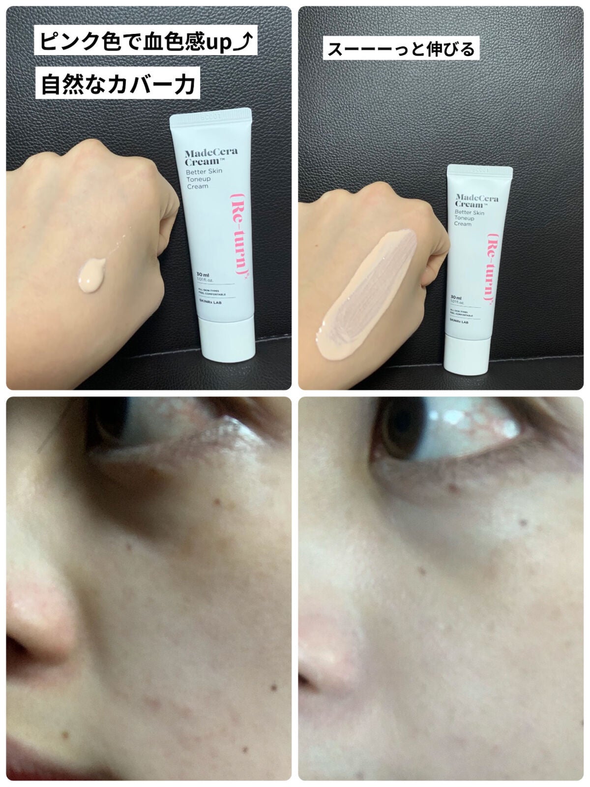 マデセラクリーム/SKINRx LAB/フェイスクリームを使ったクチコミ(2枚目)