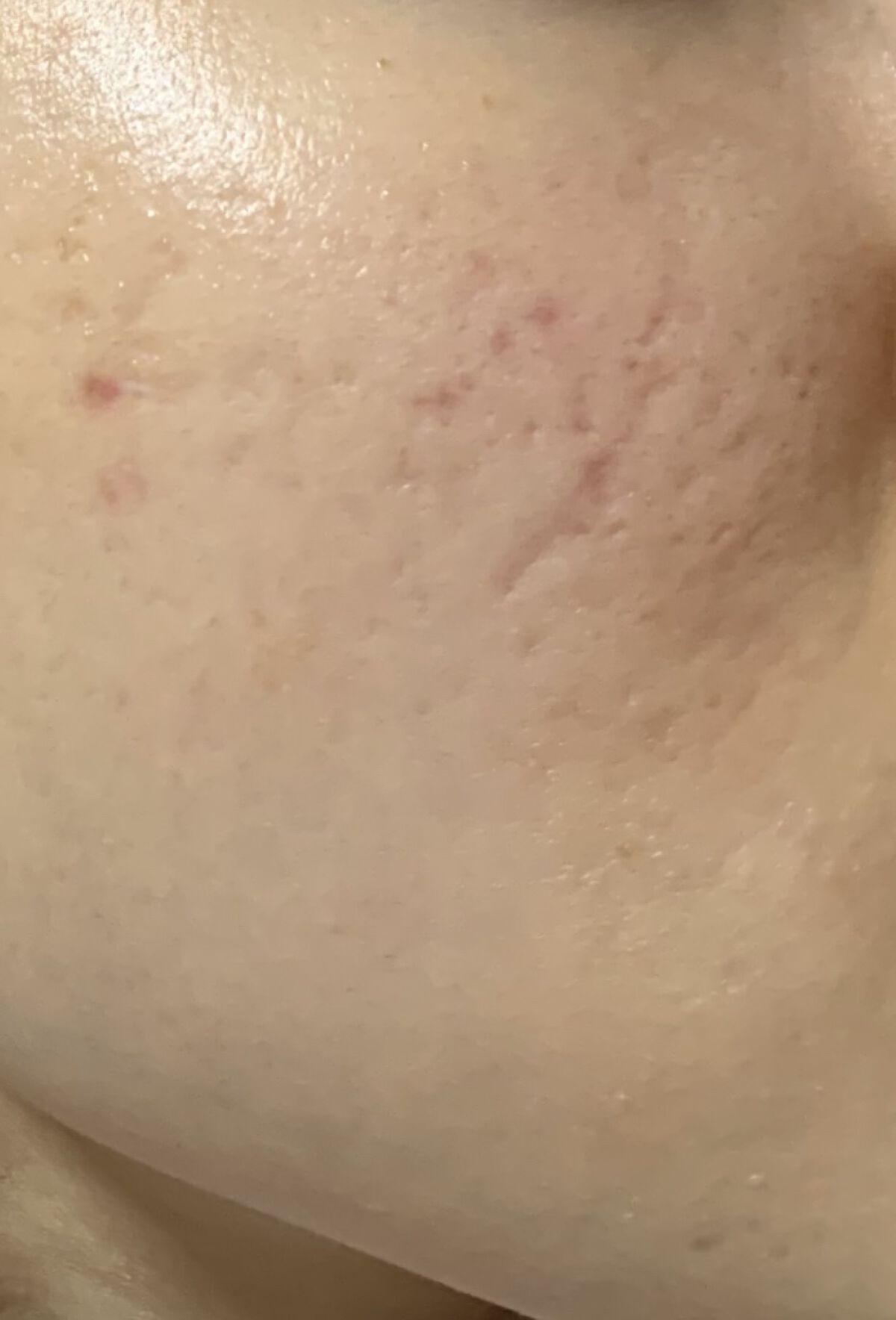 化粧水・敏感肌用・高保湿タイプ/無印良品/化粧水を使ったクチコミ（3枚目）