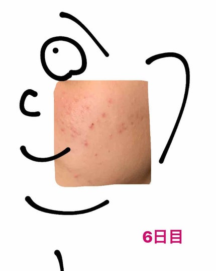 を使ったクチコミ(1枚目)