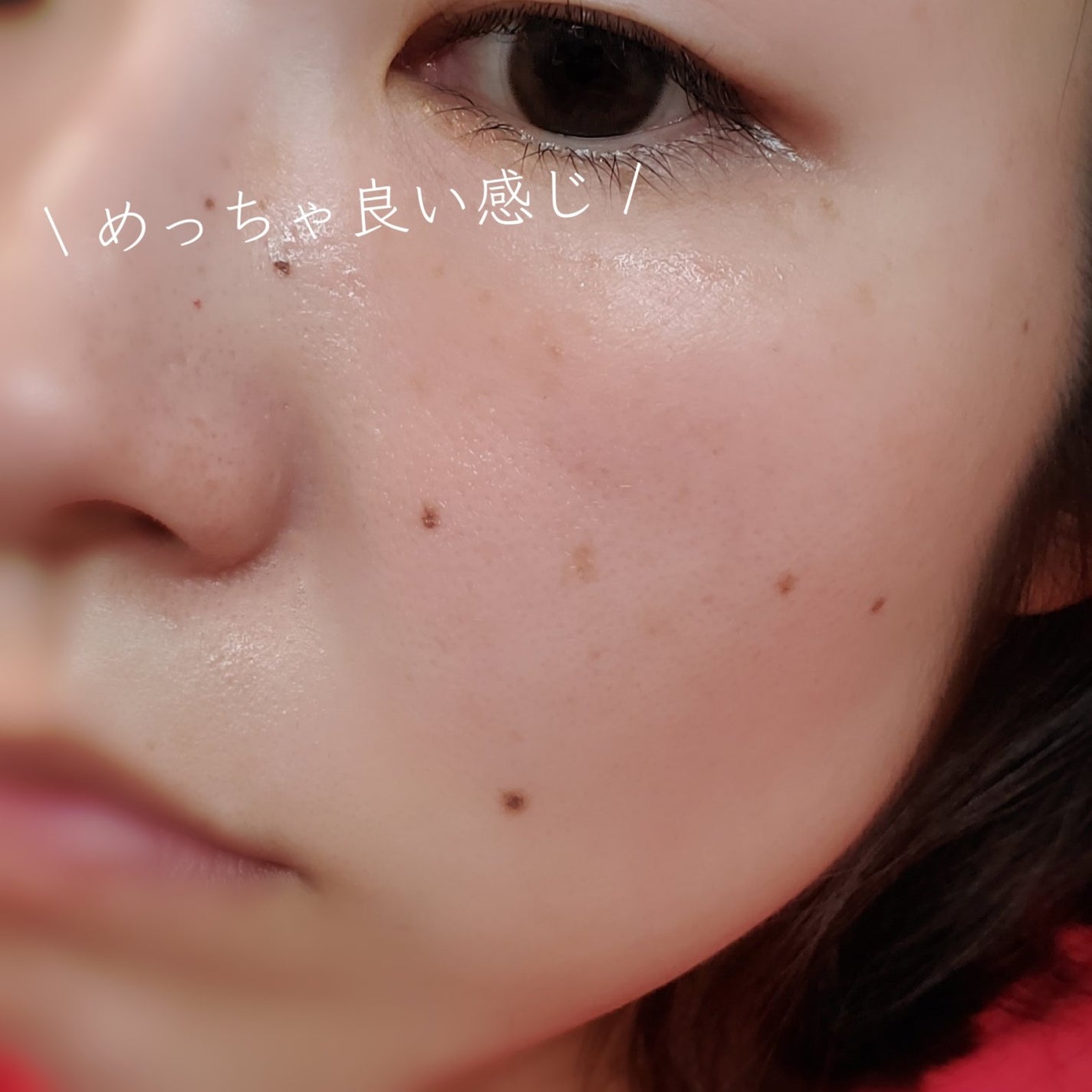 ピンクティーツリーシナジーセラム/APLIN/美容液を使ったクチコミ(6枚目)