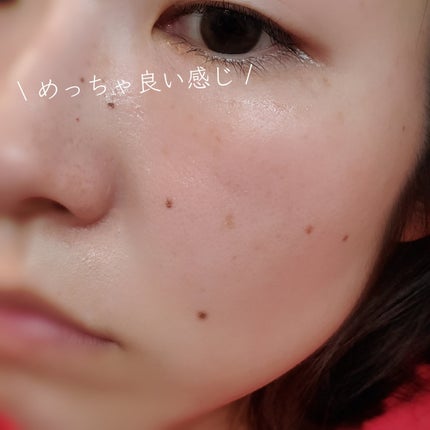 ピンクティーツリーシナジーセラム/APLIN/美容液を使ったクチコミ(6枚目)