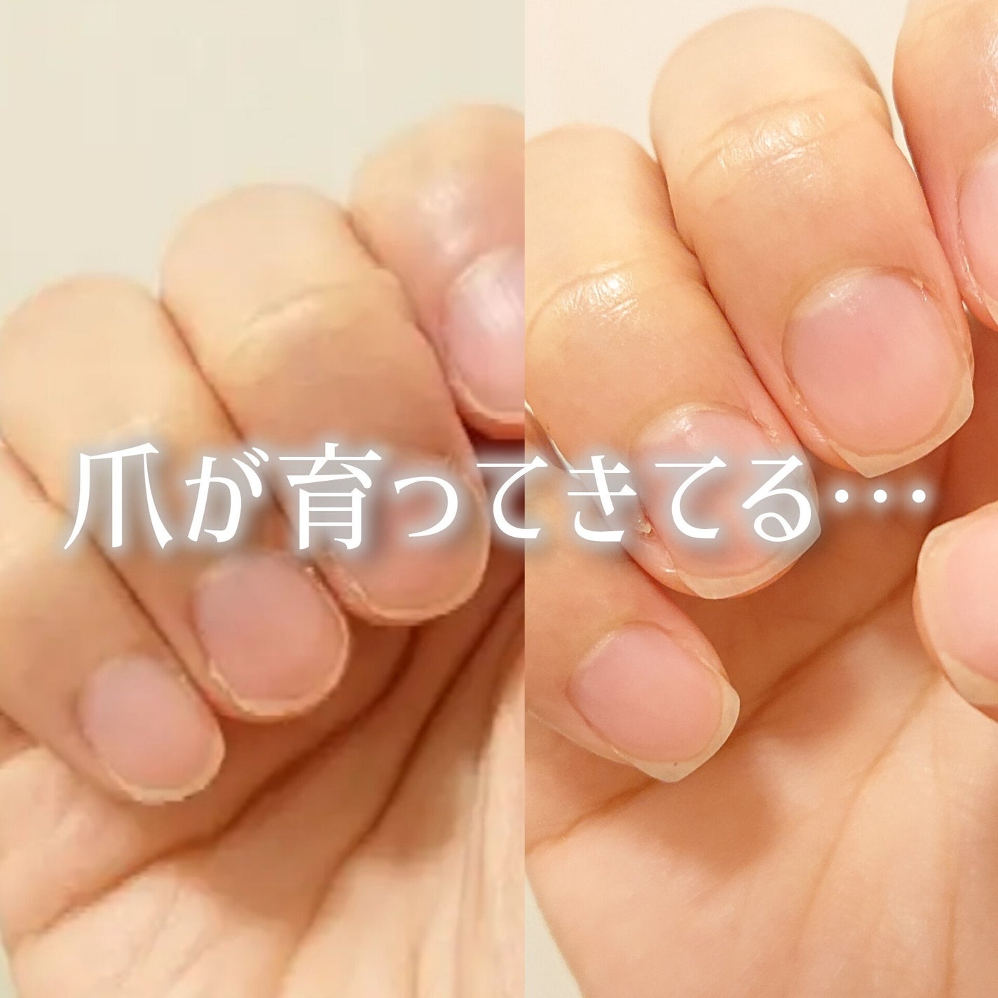 シア ネイルオイル/L'OCCITANE/ネイルオイル・トリートメントを使ったクチコミ(1枚目)