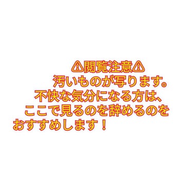 毛穴パック炭 10枚入/matsukiyo/シートマスク・パックを使ったクチコミ（2枚目）