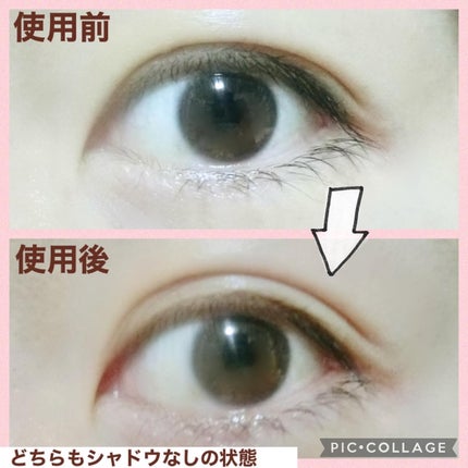 メザイク イージークリア 接着クリアタイプ/メザイク/二重まぶた用アイテムを使ったクチコミ(4枚目)
