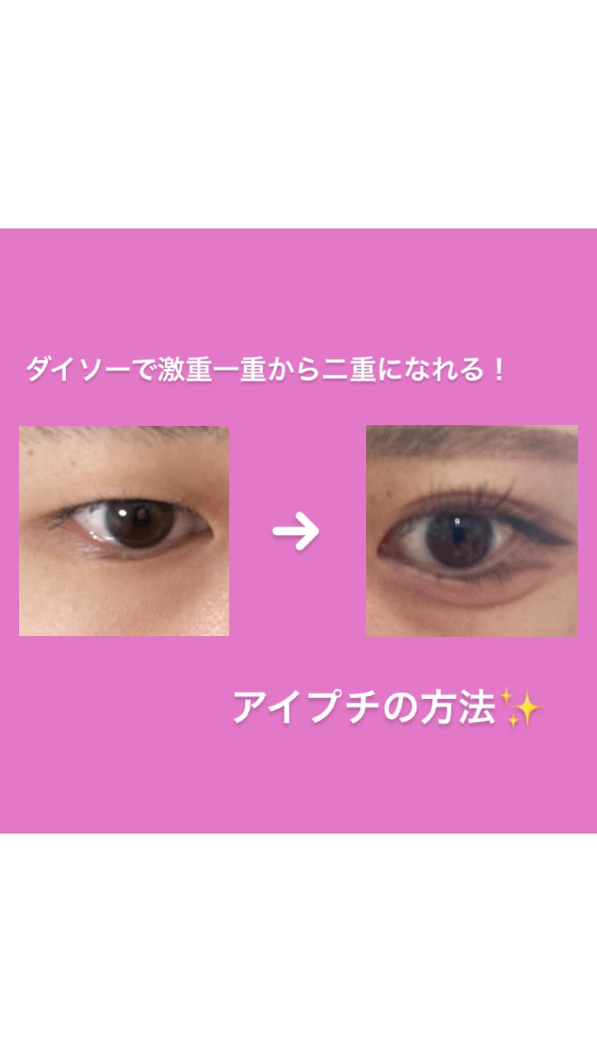 アイトーク/アイトーク/二重まぶた用アイテムを使ったクチコミ(1枚目)