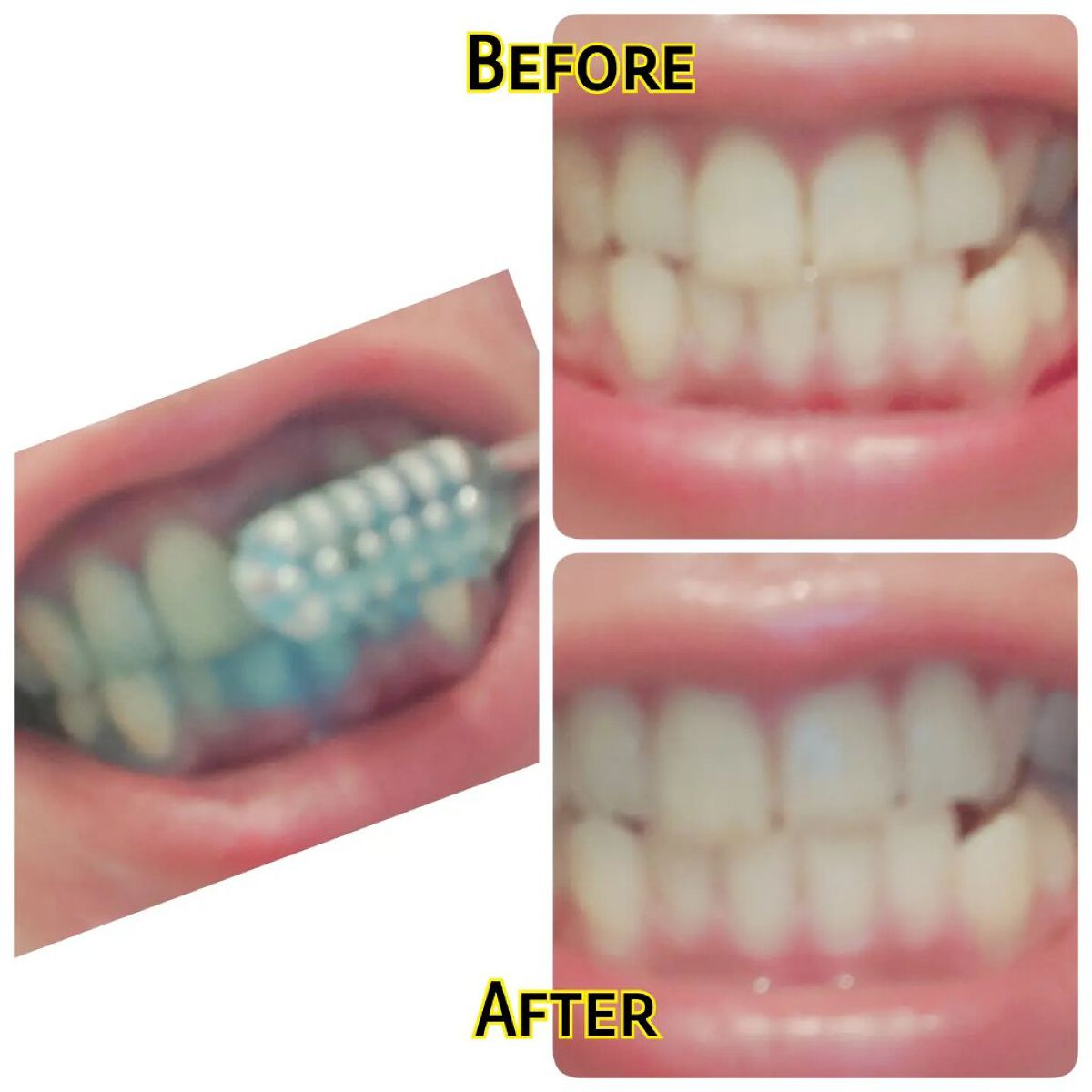 PTPハミガキ /プレビュート/歯磨き粉を使ったクチコミ（2枚目）