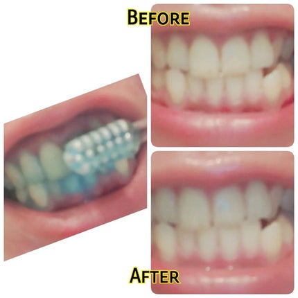 PTPハミガキ /プレビュート/歯磨き粉を使ったクチコミ(2枚目)