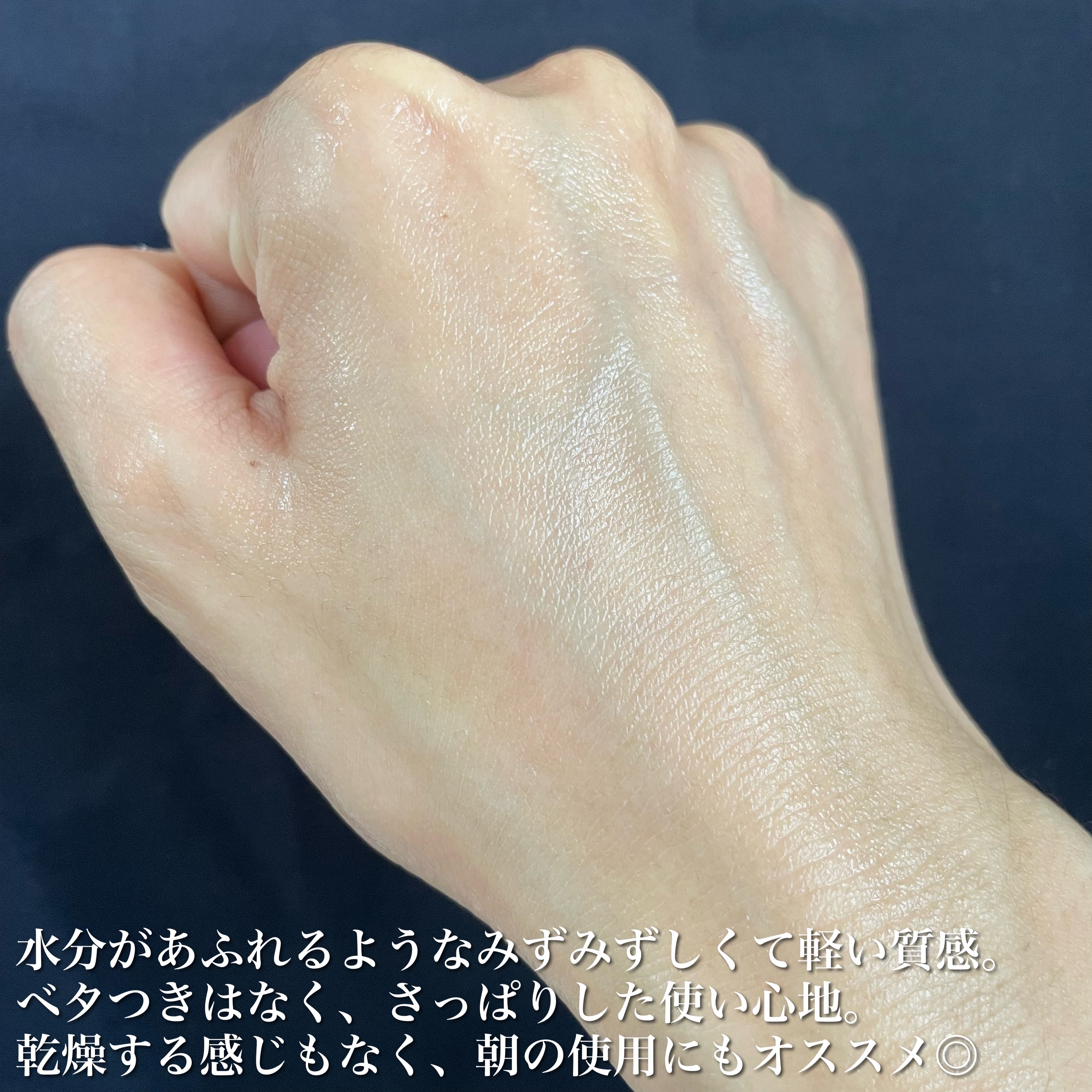 試してみた】シカ水分クリーム Dr.Belmeurの効果・肌質別の口コミ