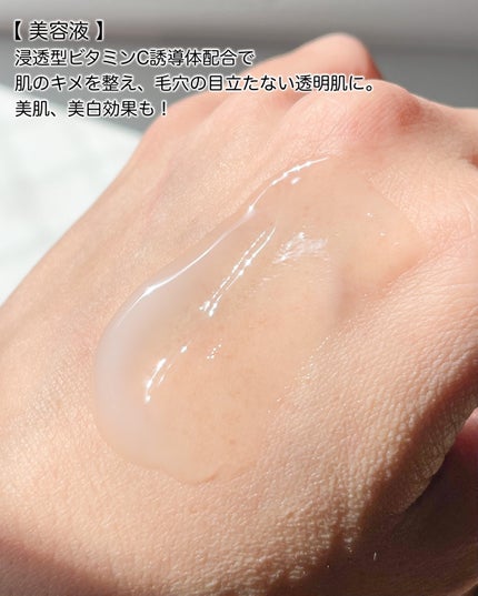 チョコブラ スペシャル毛穴ケアセット/Chocobra/スキンケアキットを使ったクチコミ(5枚目)