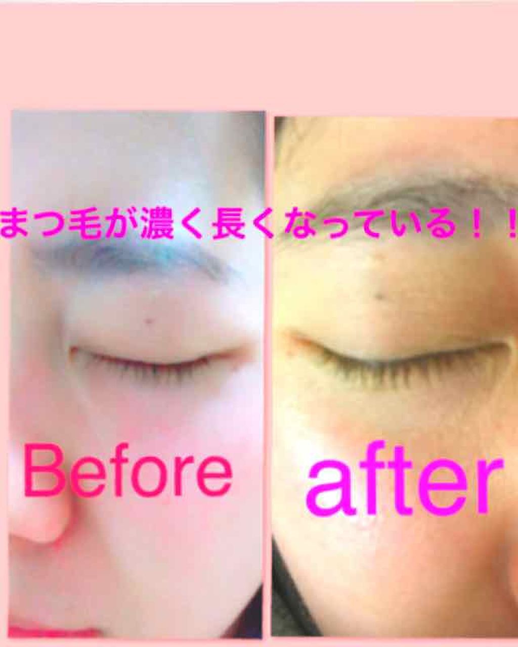 リバイタラッシュ アドバンス ジャパン/エム・アール・アイ/まつげ美容液を使ったクチコミ（2枚目）