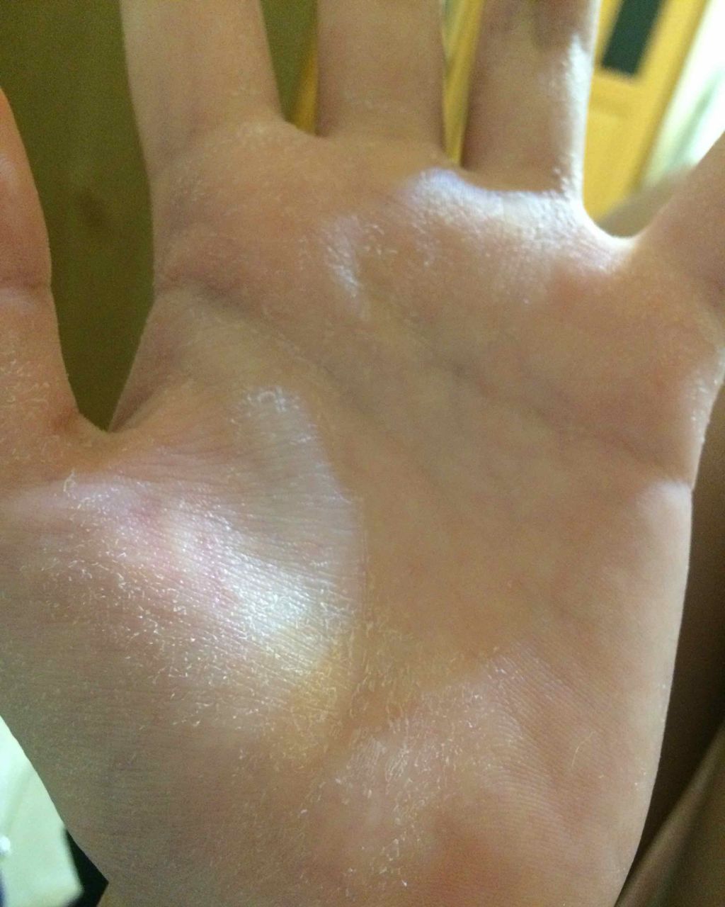 パワー10/It's skin/美容液を使ったクチコミ（2枚目）